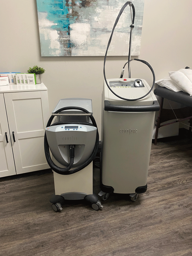 Cynosure Elite Plus Laser Equipment